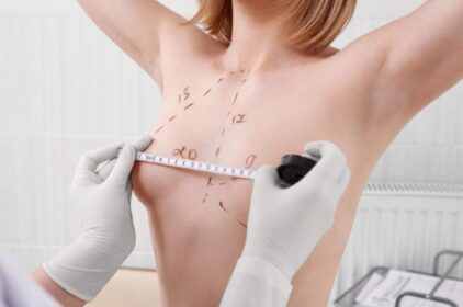 Nâng ngực nội soi